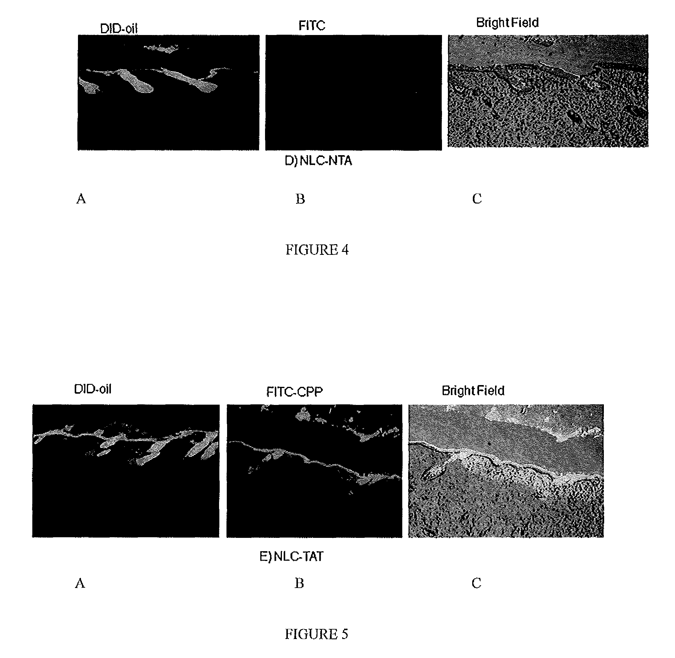 Nanoparticle formulations for skin delivery