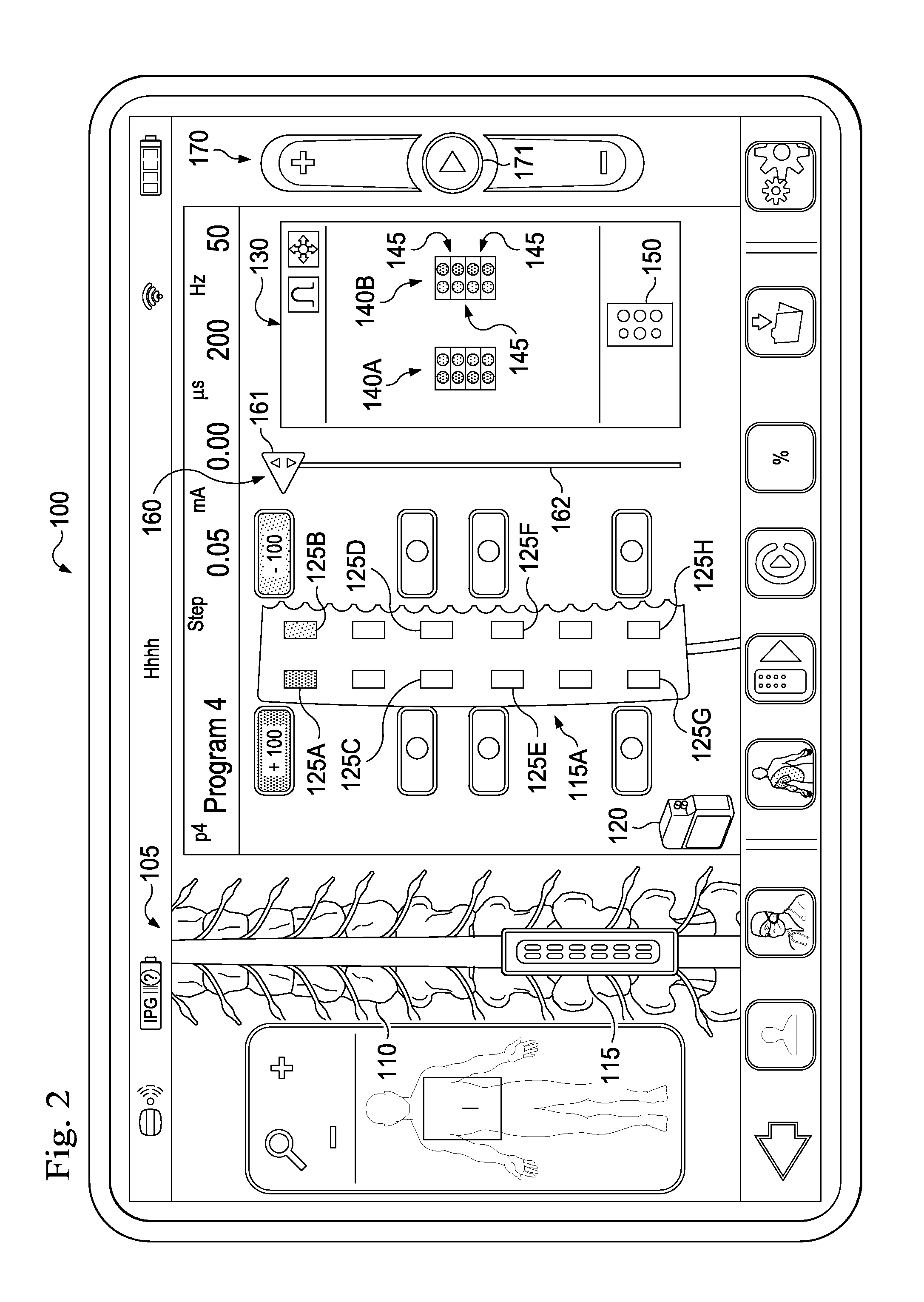 Method and system of quick neurostimulation electrode configuration and positioning