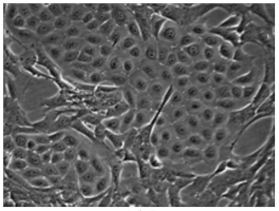 Separation and purification method of goat mammary epithelial cells