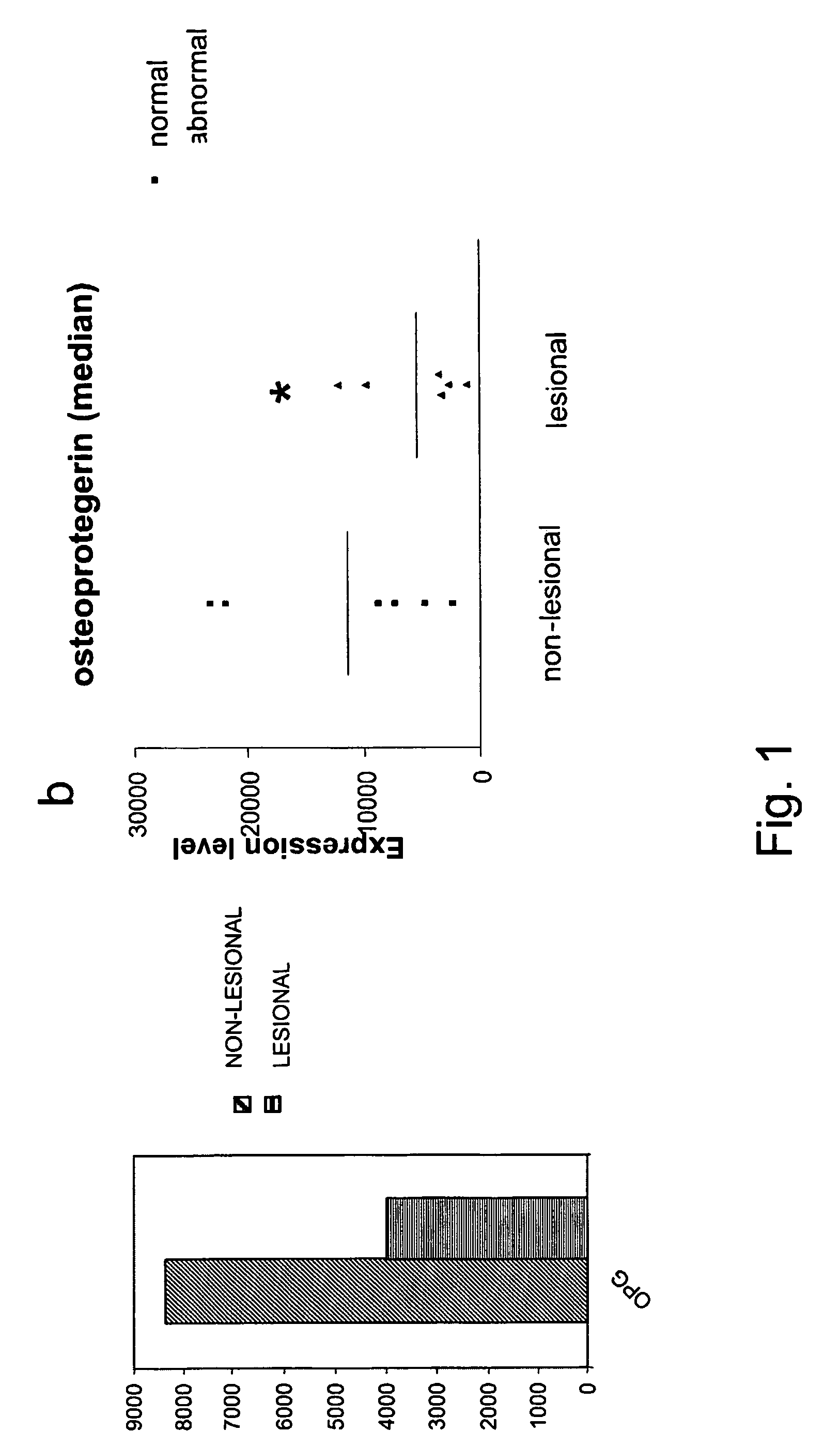 Use of osteoprotegerin for the treatment and/or prevention of fibrotic disease