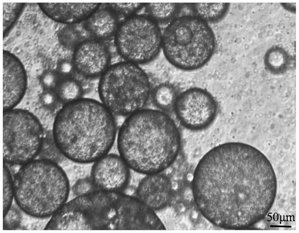 Sodium alginate modified ropivacaine hydrochloride multivesicular liposome microsphere as well as preparation method and application thereof