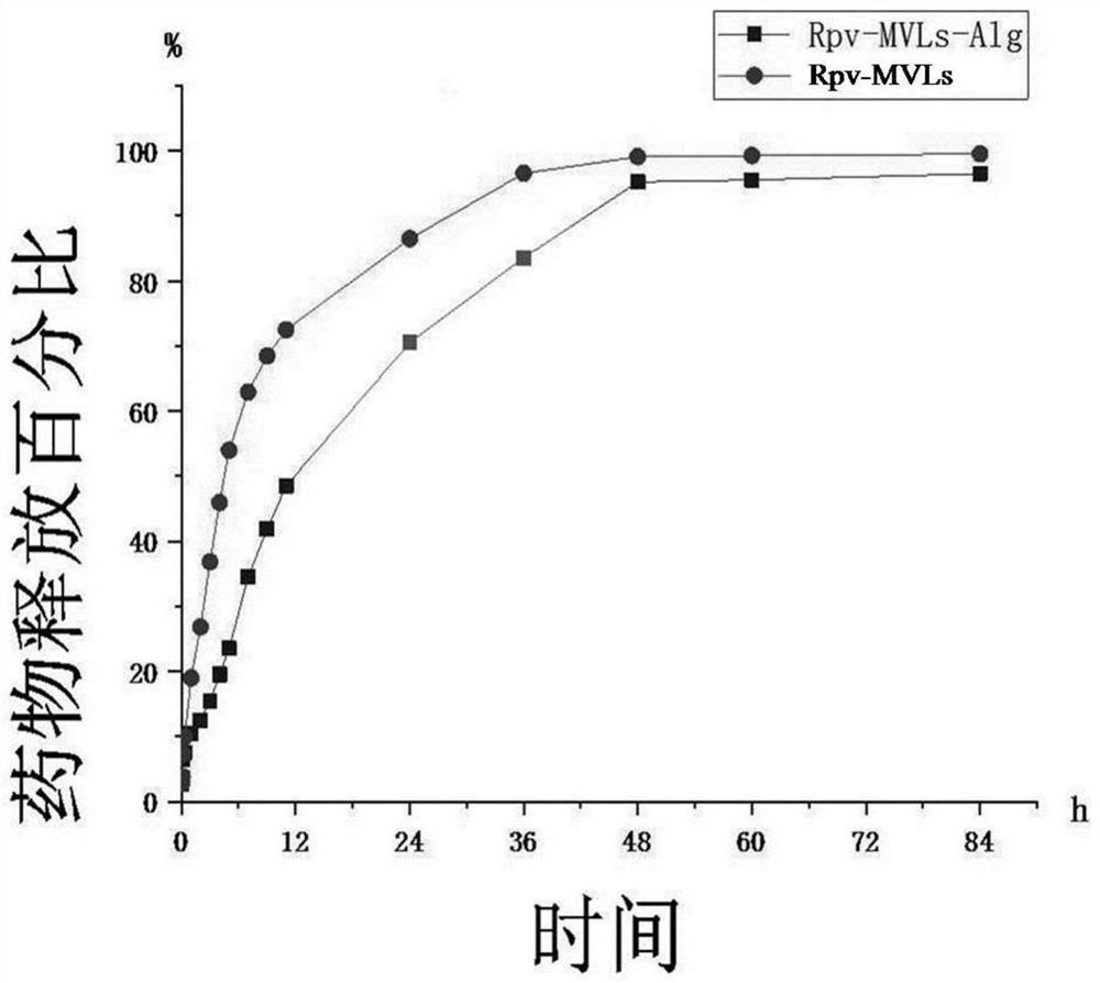 Sodium alginate modified ropivacaine hydrochloride multivesicular liposome microsphere as well as preparation method and application thereof