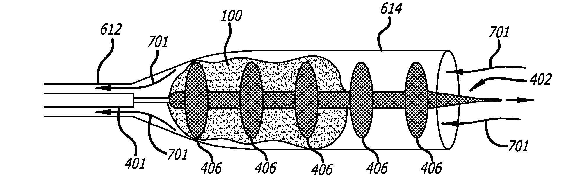 Methods And Apparatus For Treating Embolism