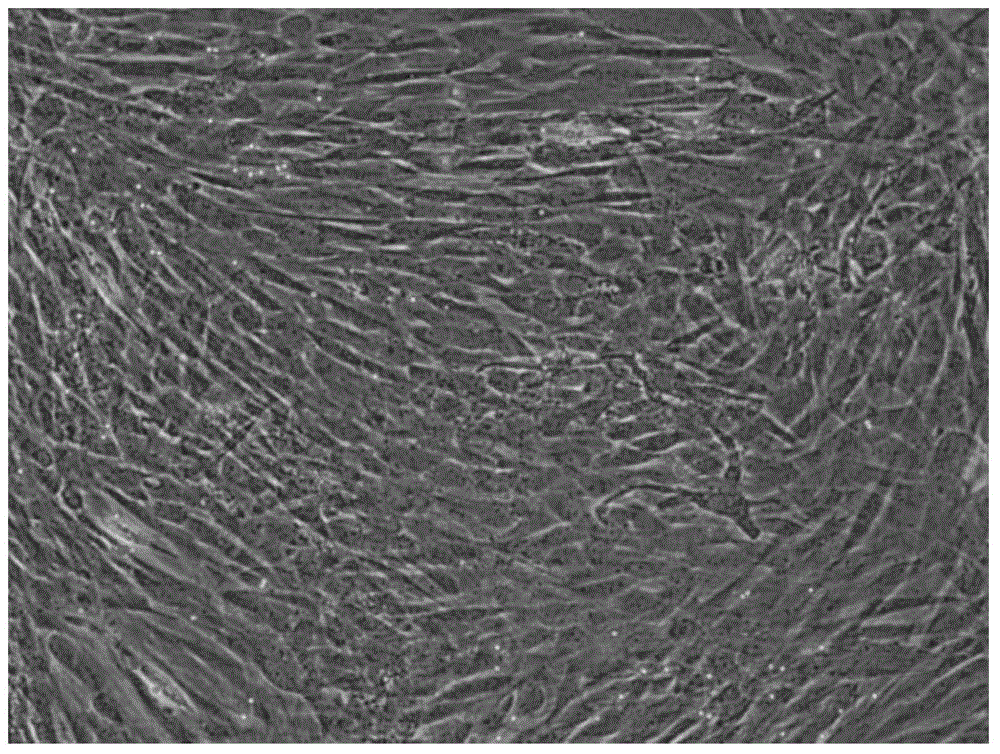 Serum-free medium for culturing placental mesenchymal stem cells