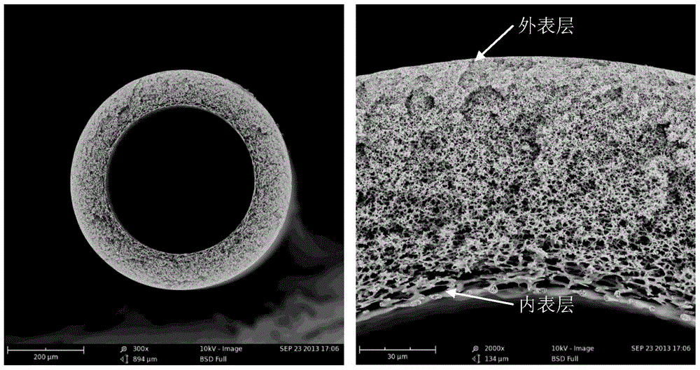 A kind of superhydrophilic gradient hole hollow fiber membrane and its preparation method