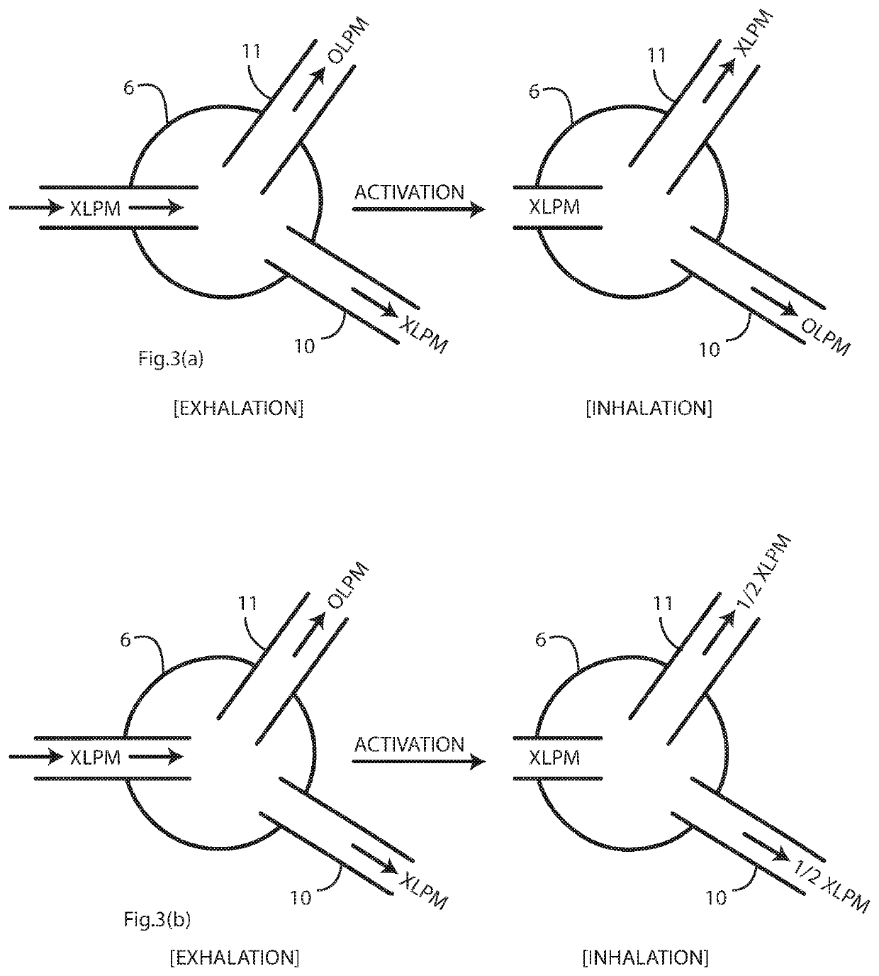 High flow nasal therapy system