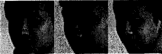 Human face similarity degree matching method and device