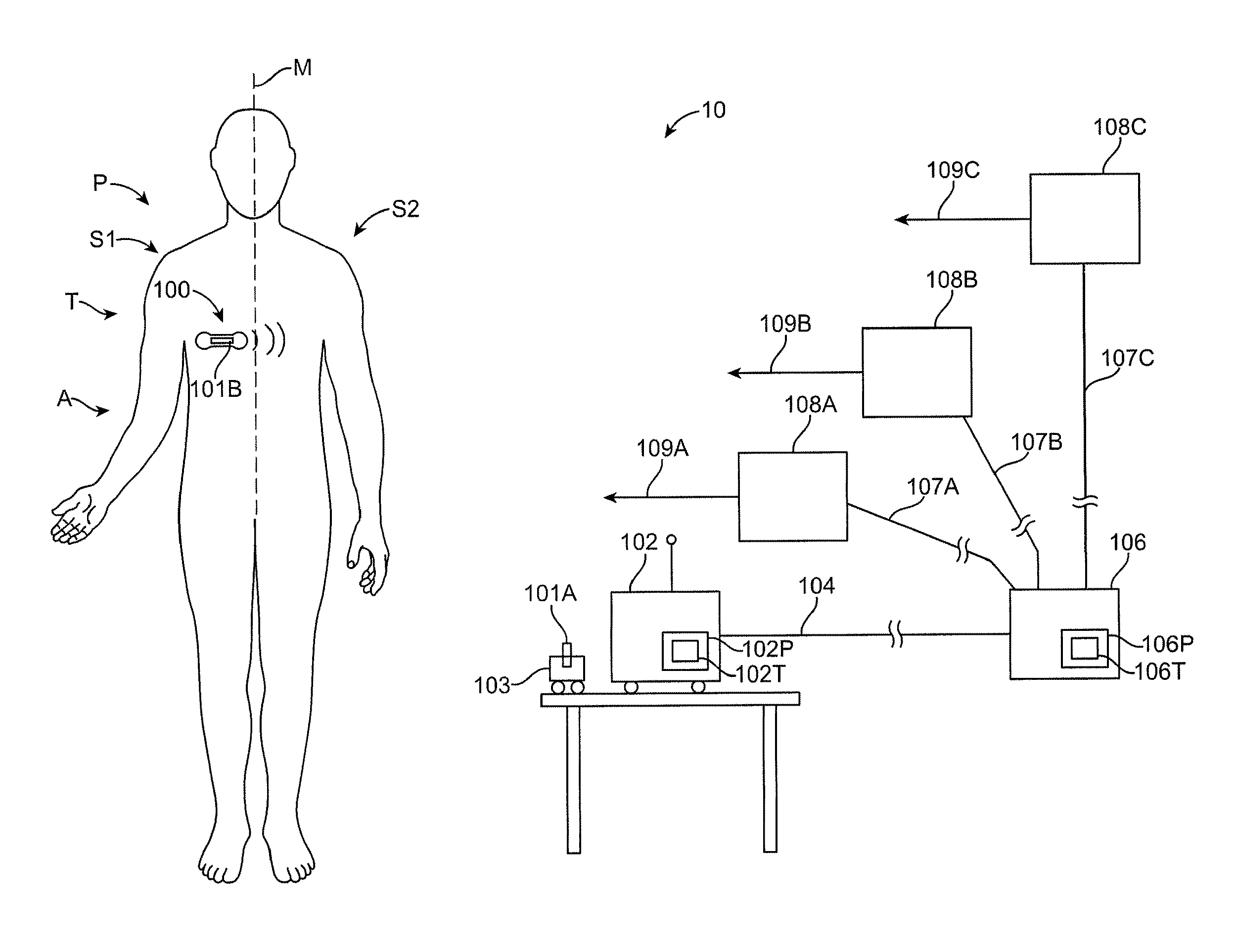 Method and apparatus for remote detection and monitoring of functional chronotropic incompetence