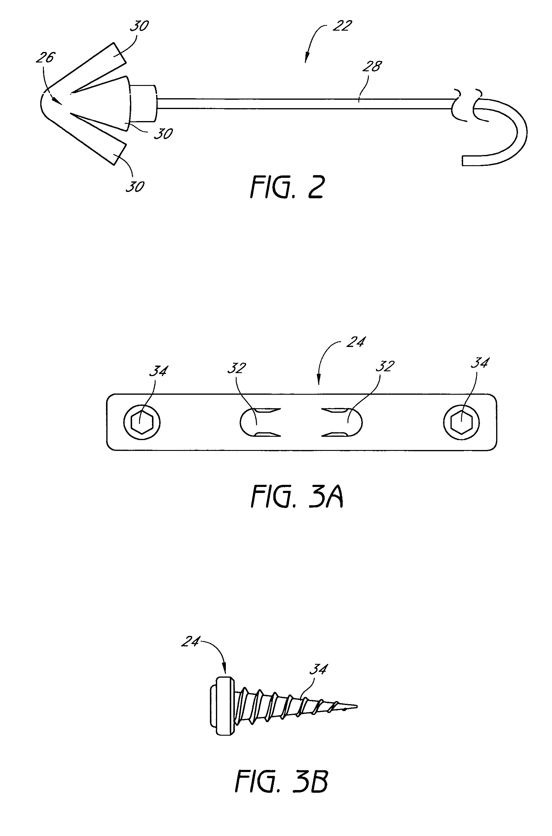 Tissue anchoring system for percutaneous glossoplasty