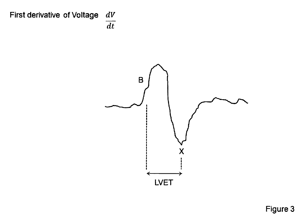 Methods and apparatus for the on-line and real time acquisition and analysis of voltage plethysmography, electrocardiogram and electroencephalogram for the estimation of stroke volume, cardiac output, and systemic inflammation