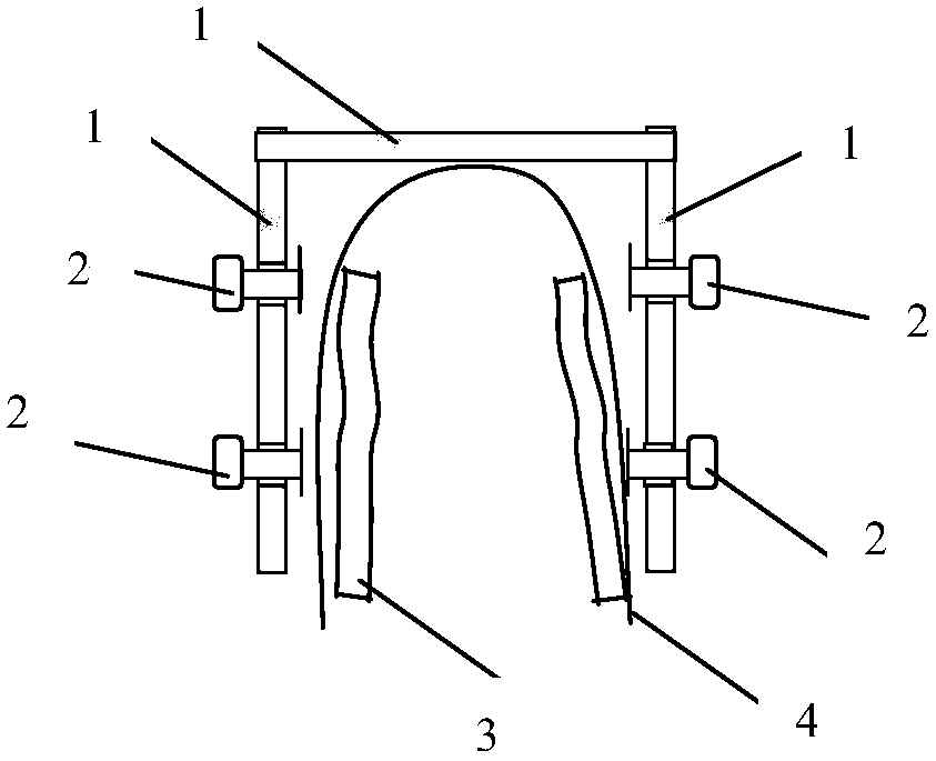 An orthopedic fixator for the exterior of the clavicle