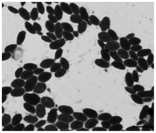 Saccharomyces cerevisiae strain FM-S-LB1 capable of reducing fermentation abortion rate of blueberry wine