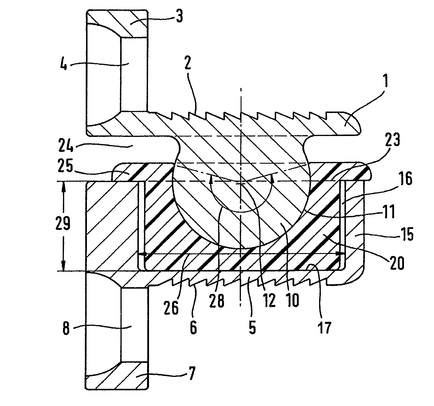 Cervical intervertebral prosthesis