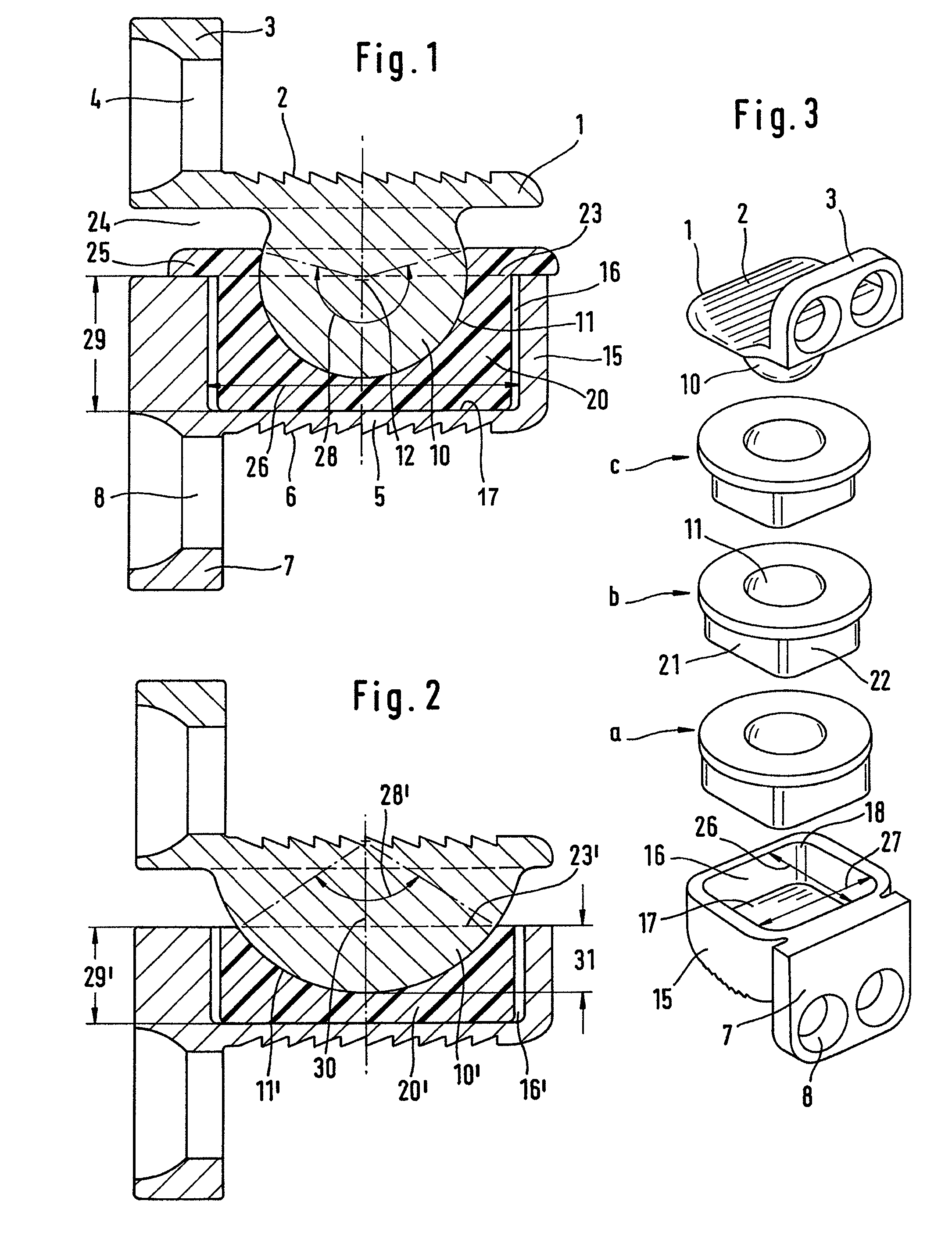 Cervical intervertebral prosthesis