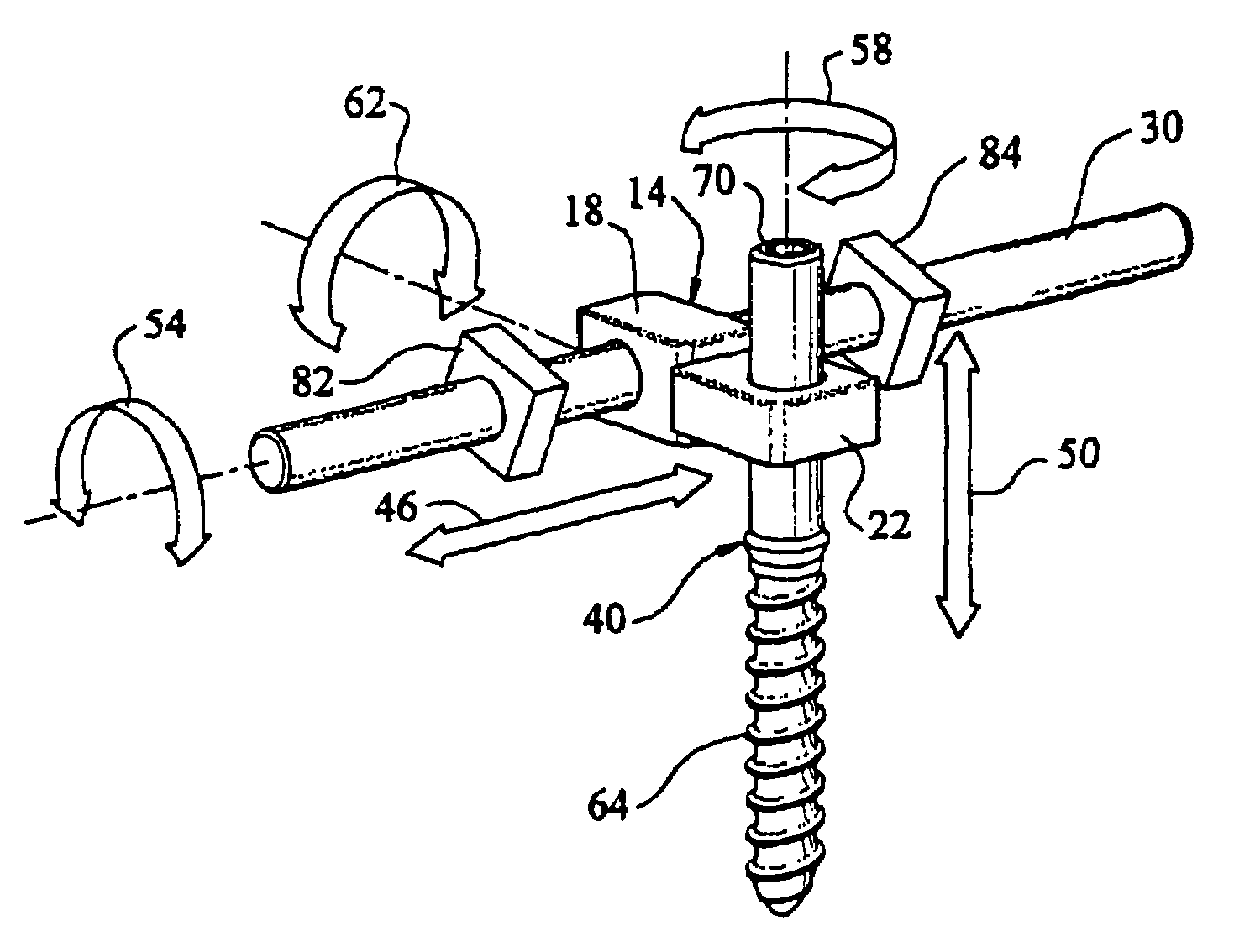 Method for creating an artificial facet