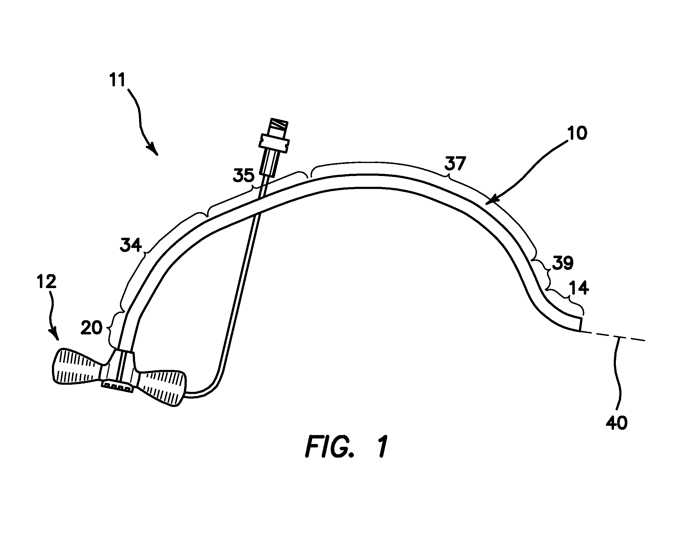 Method and Apparatus for a Right-Sided Short Sheath