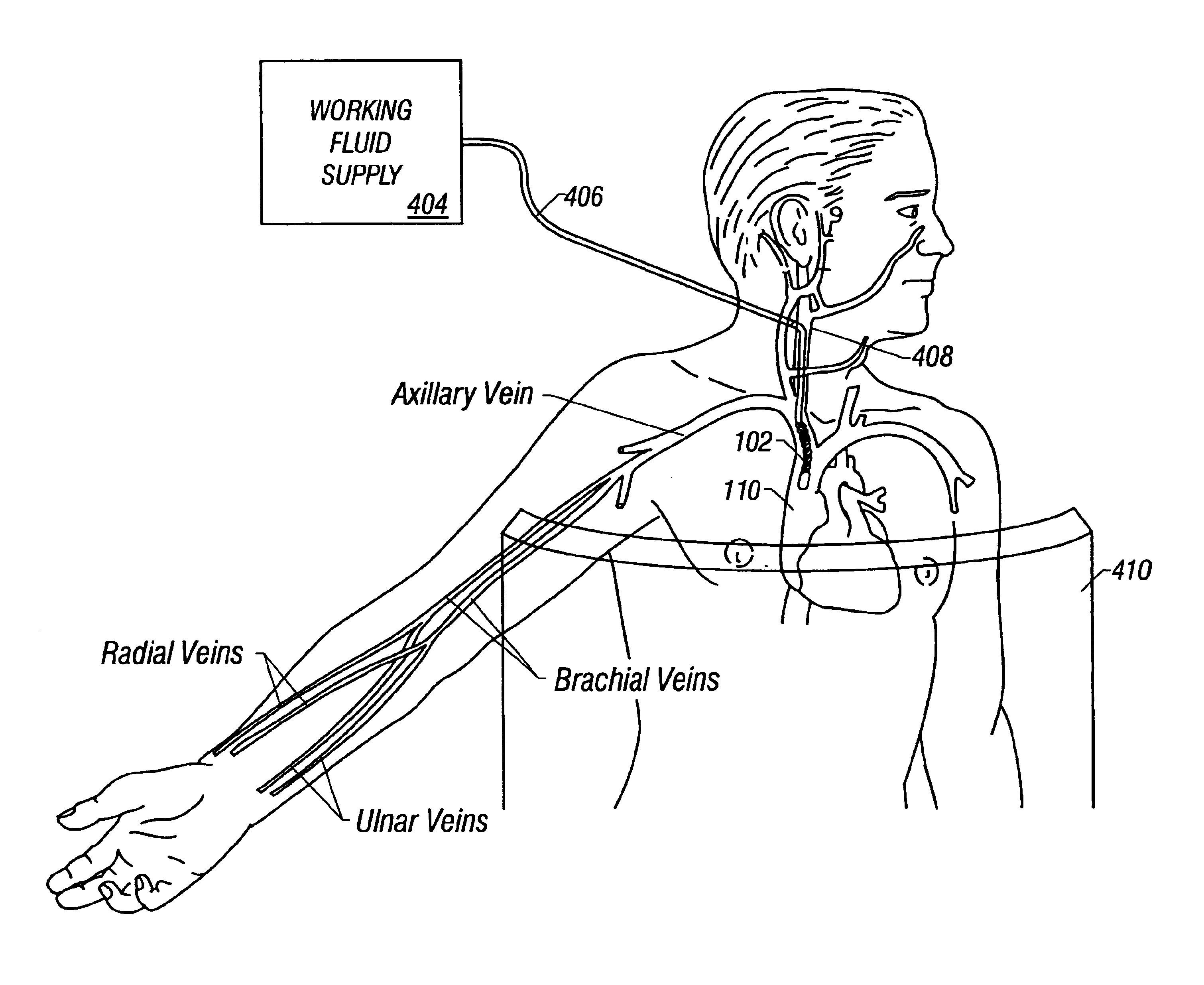 Method and device for patient temperature control employing optimized rewarming