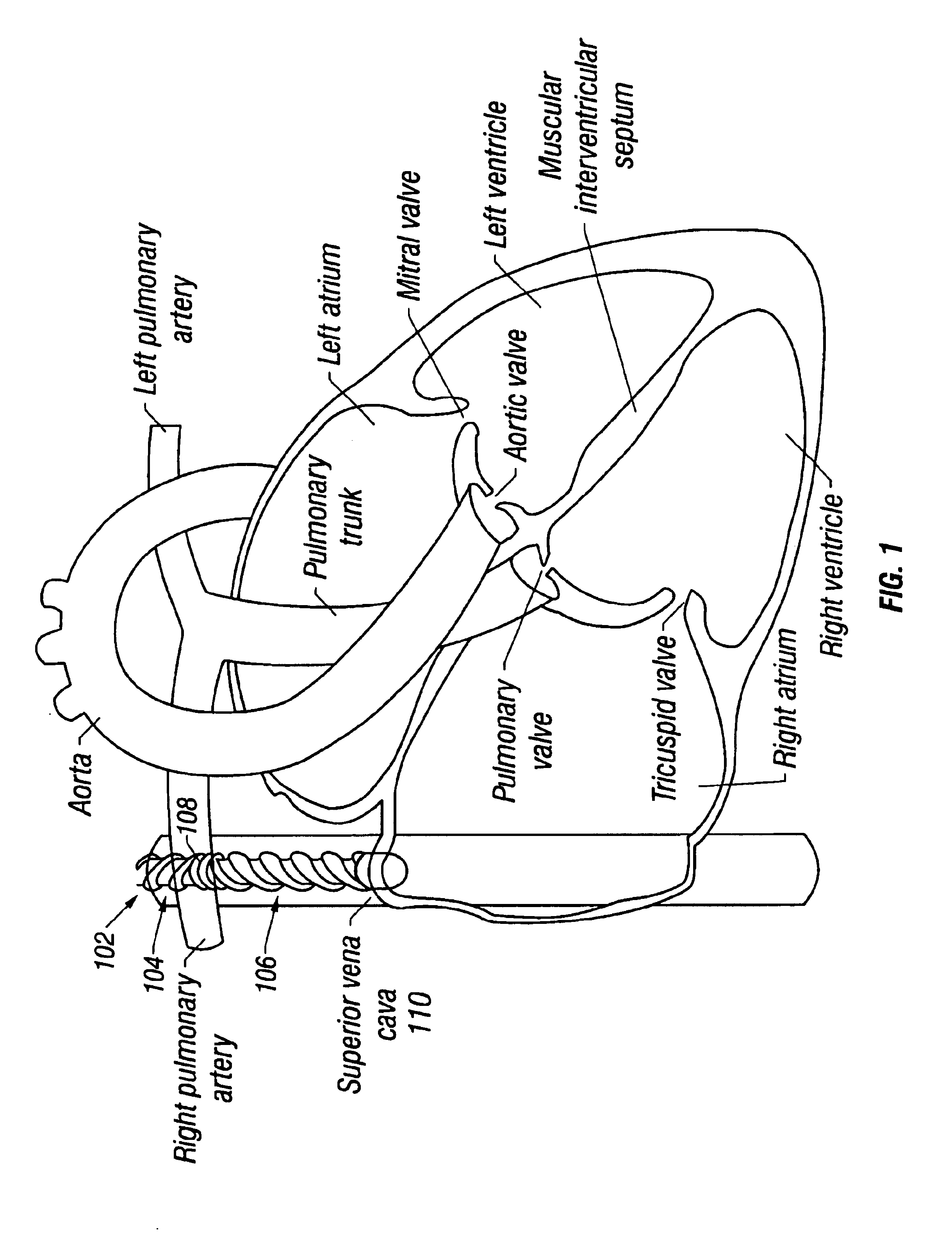 Method and device for patient temperature control employing optimized rewarming