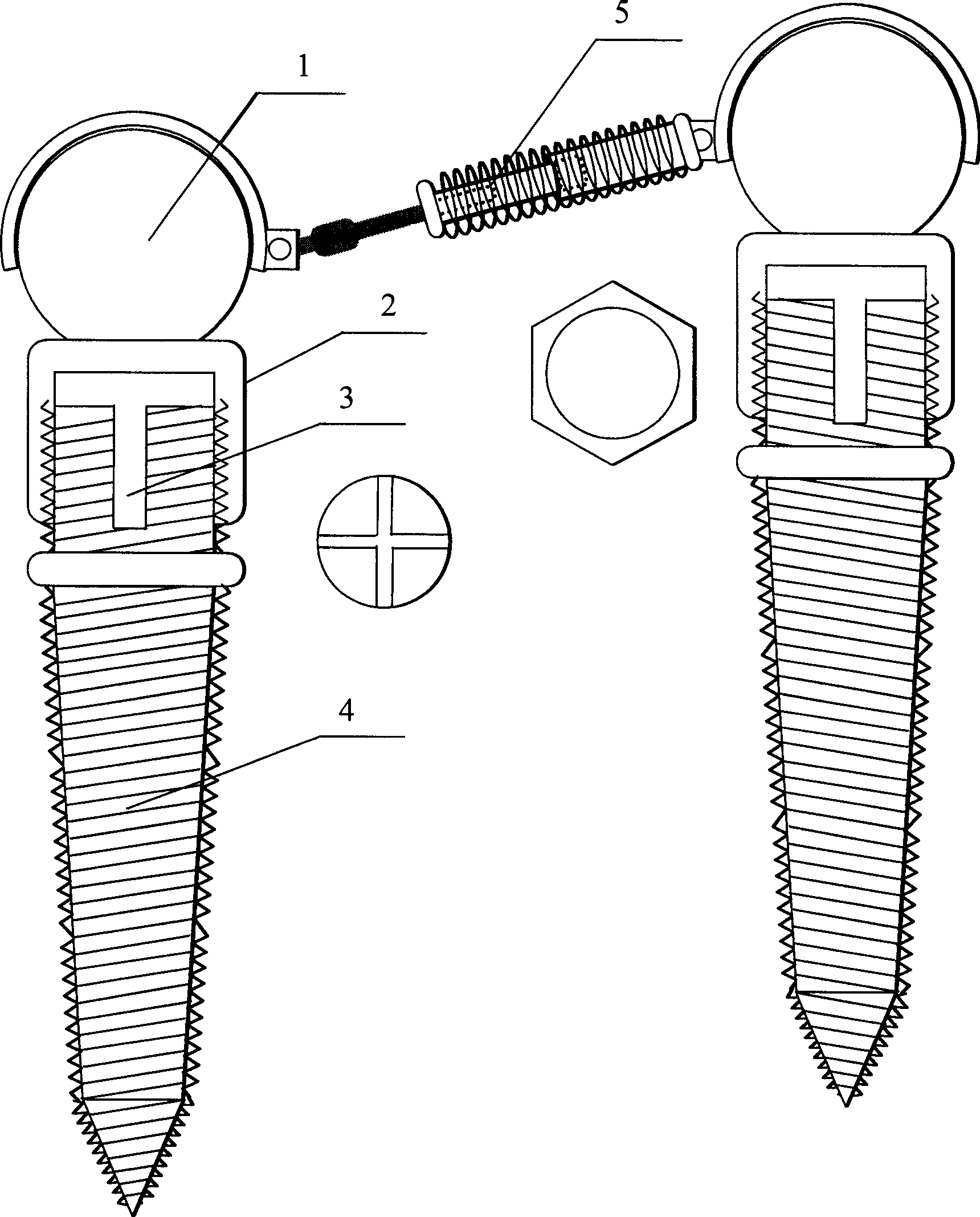 Implanter type function correction appliance