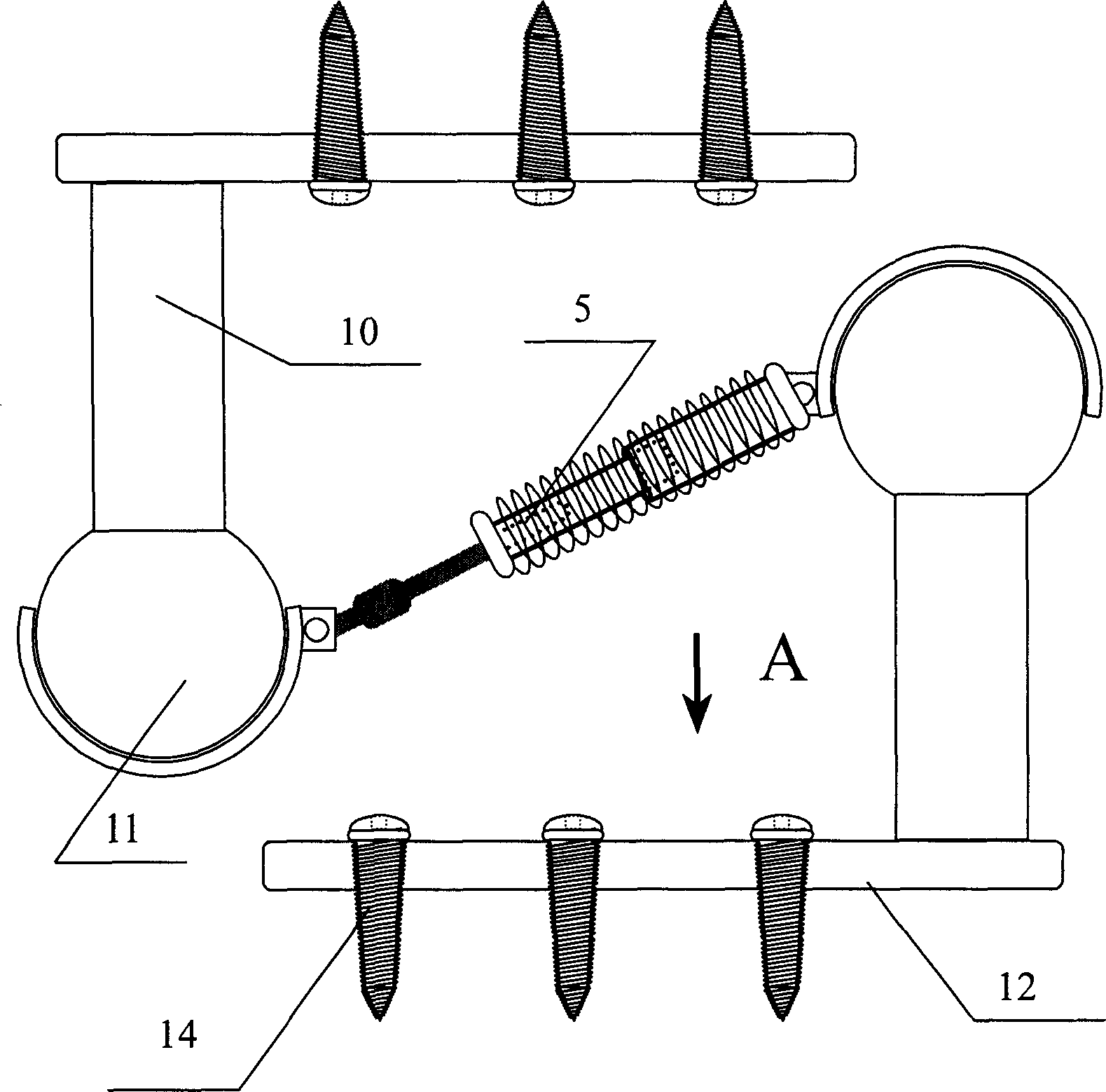 Implanter type function correction appliance