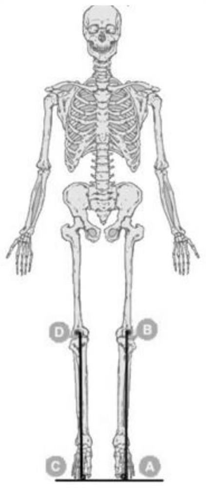 Evaluation method for sports postures of teenagers