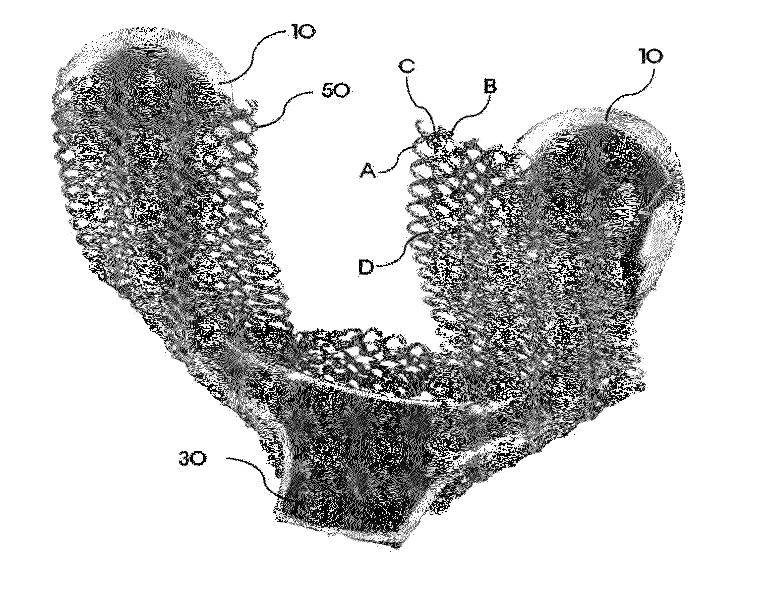 Infra-obturator tension transfer device