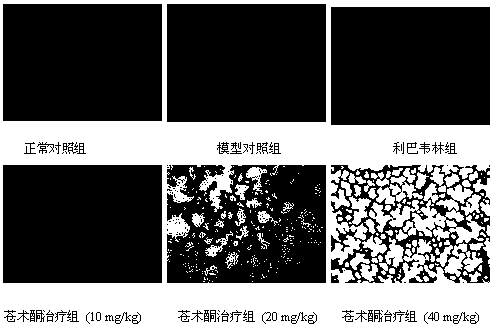 Application of atractylone in preparation of medicine for treating acute lung injury