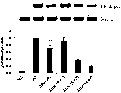 Application of atractylone in preparation of medicine for treating acute lung injury