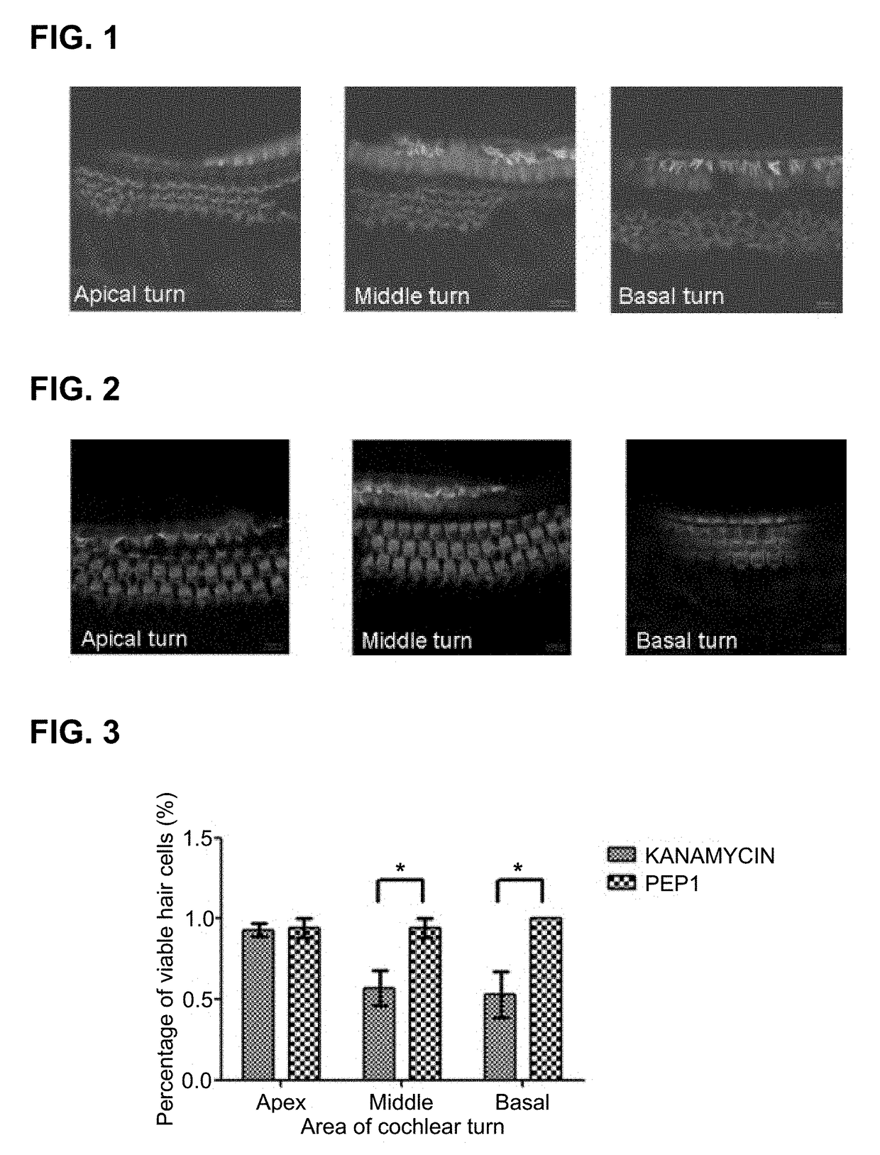 Peptide for preventing hearing loss, and composition comprising same