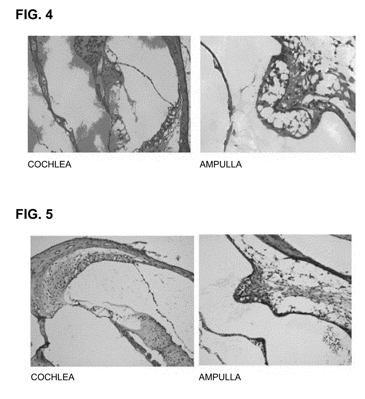 Peptide for preventing hearing loss, and composition comprising same