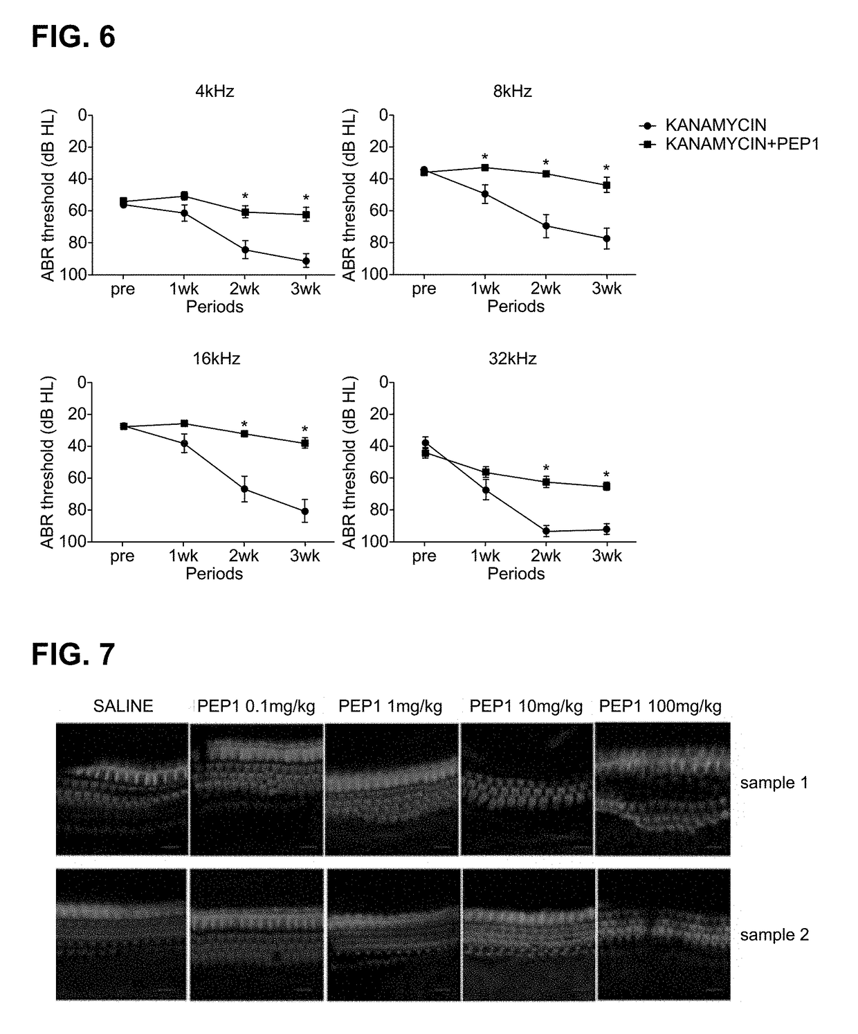 Peptide for preventing hearing loss, and composition comprising same