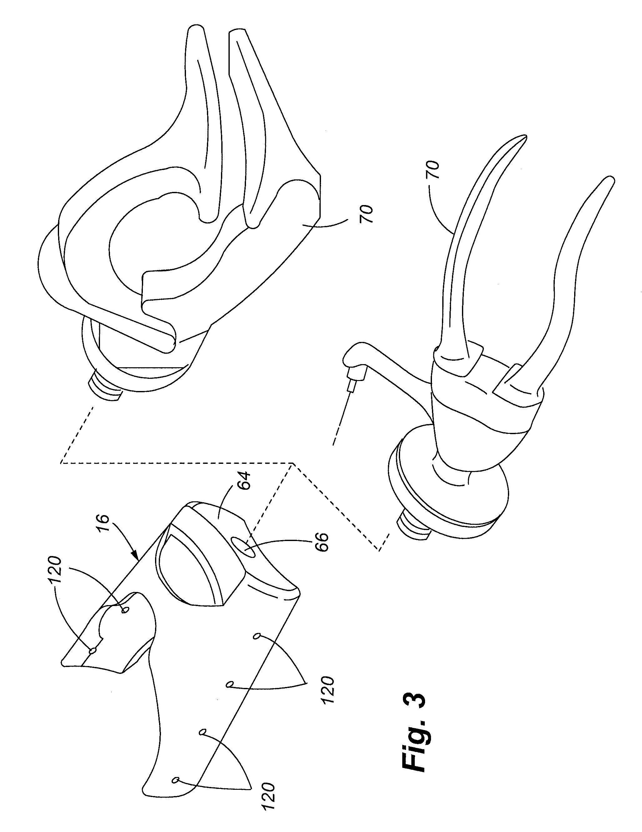 Anatomically-configured adjustable upper extremity prosthetic device