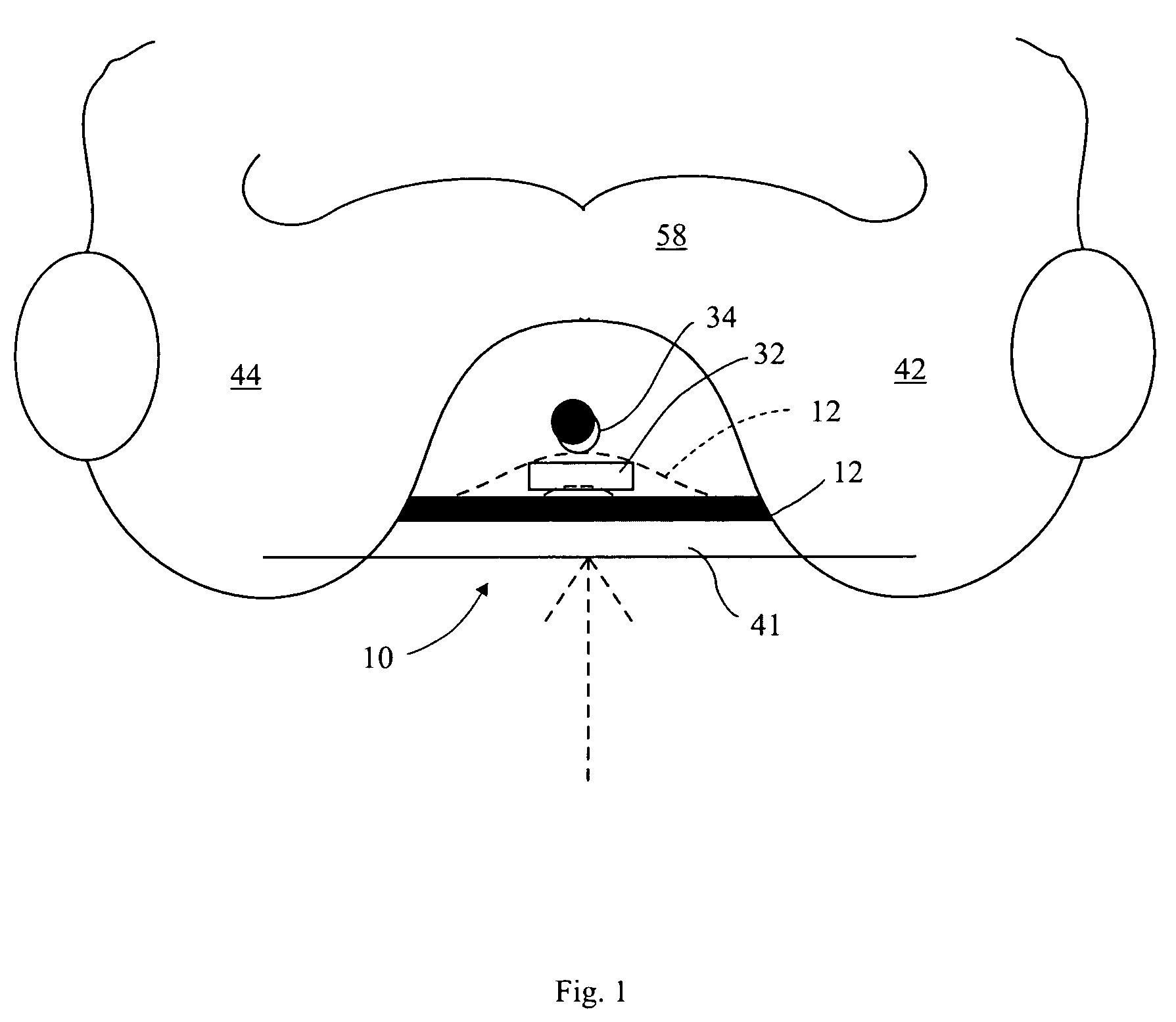 Surgically implantable perineal urinary incontinence device