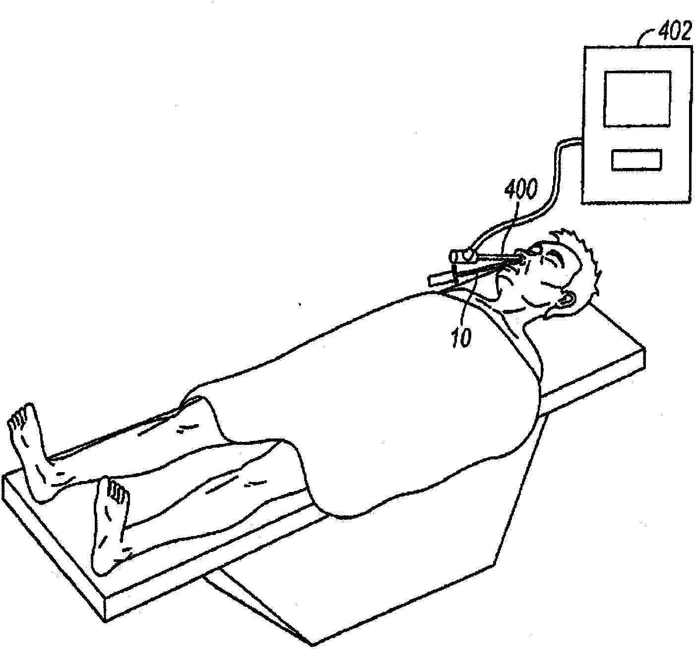 Frontal sinus spacer