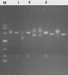 A preparation process for separating and purifying recombinant human pro-urokinase from recombinant Escherichia coli fermentation broth