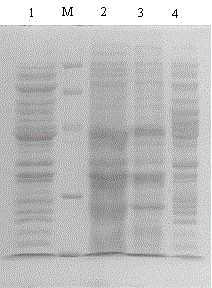 A preparation process for separating and purifying recombinant human pro-urokinase from recombinant Escherichia coli fermentation broth