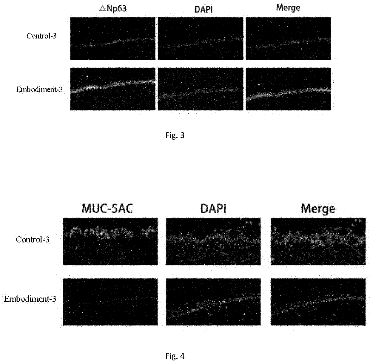 Eyedrop applicable to limbal stem cell deficiency and preparation