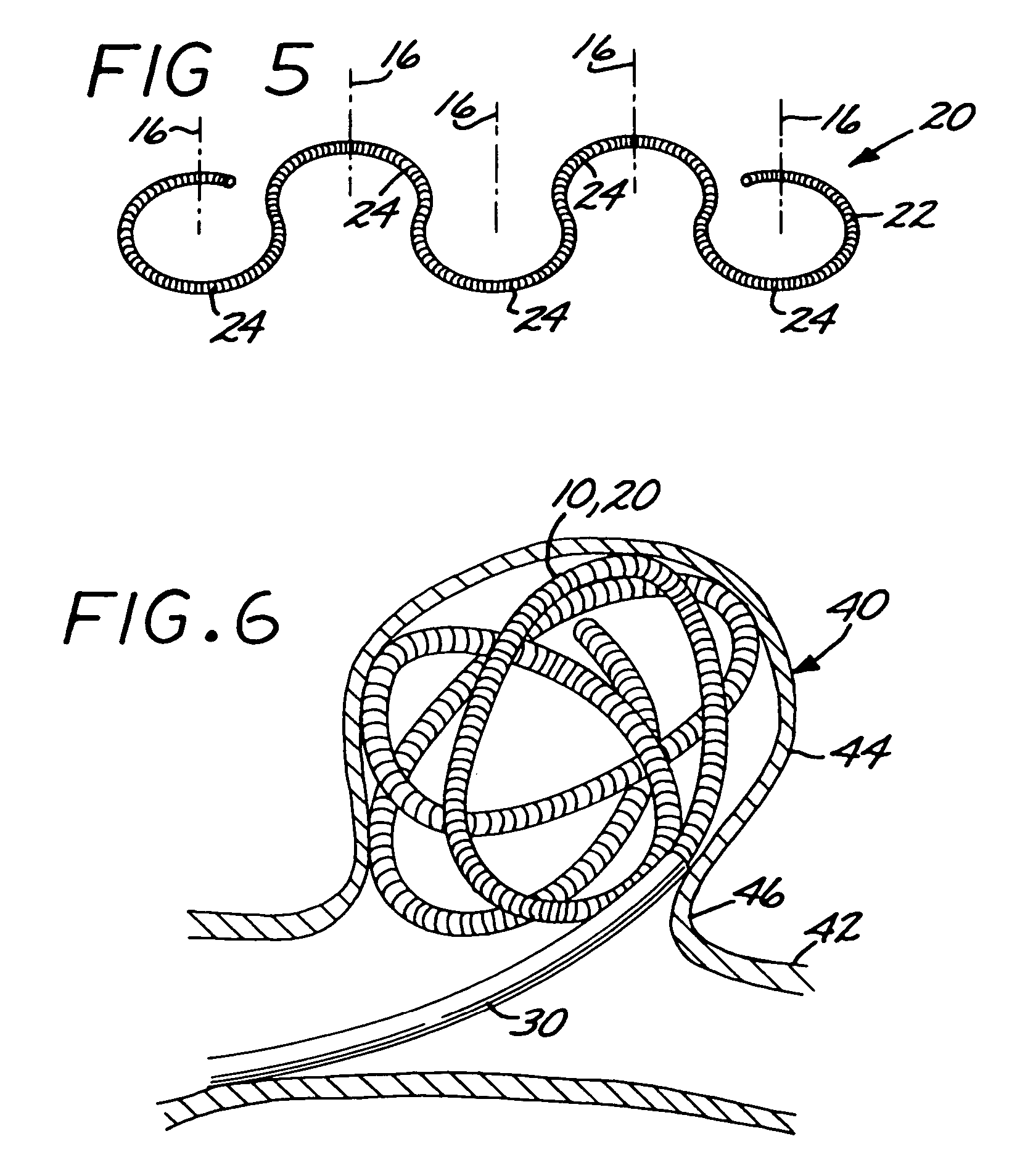 Microcoil vaso-occlusive device with multi-axis secondary configuration