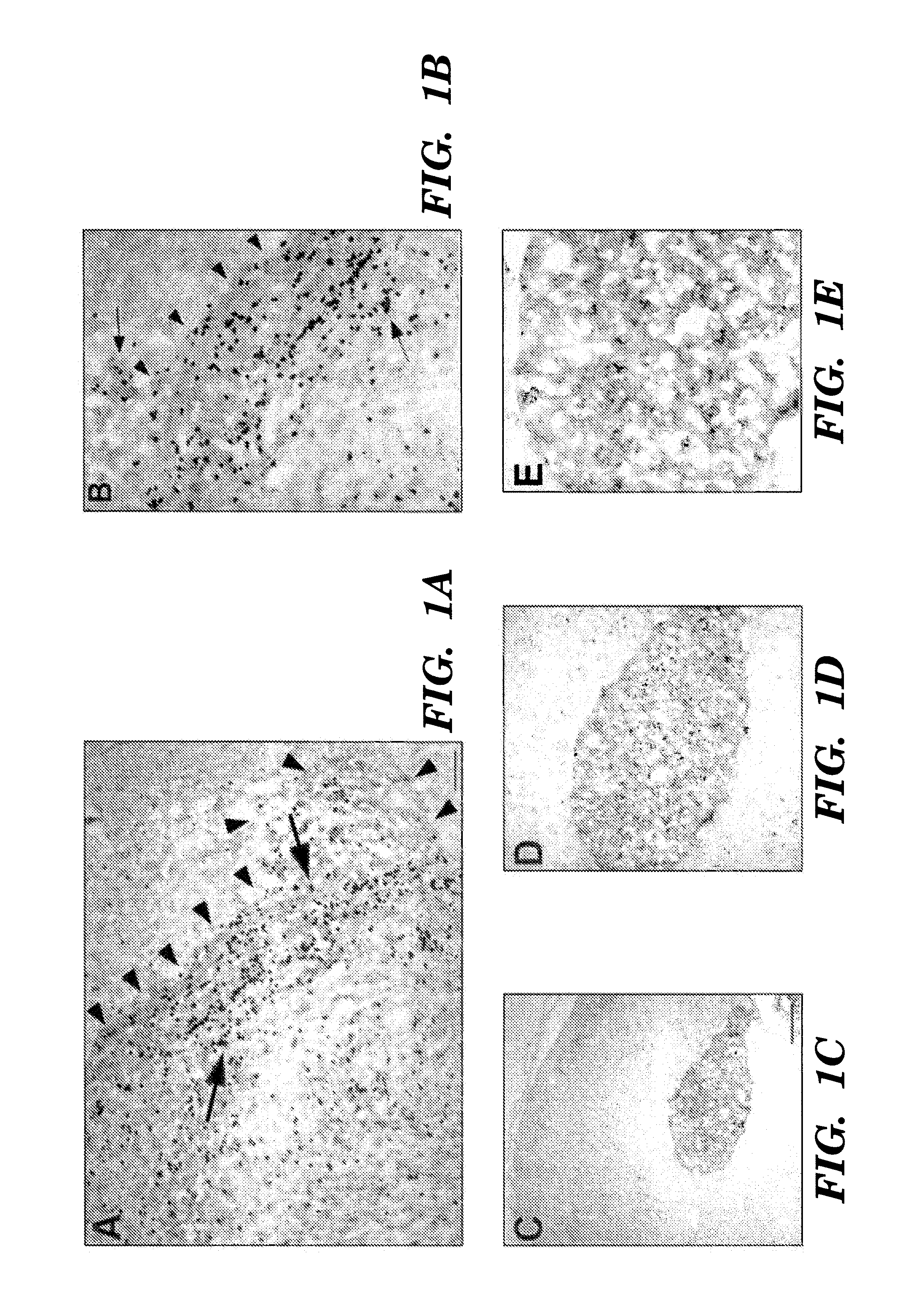 Systemic gene delivery vehicles for the treatment of tumors