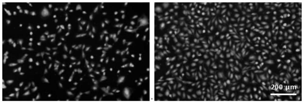 Fully-degradable heart occluder coating for promoting cardiac muscle tissue repair and preparation method of fully-degradable heart occluder coating