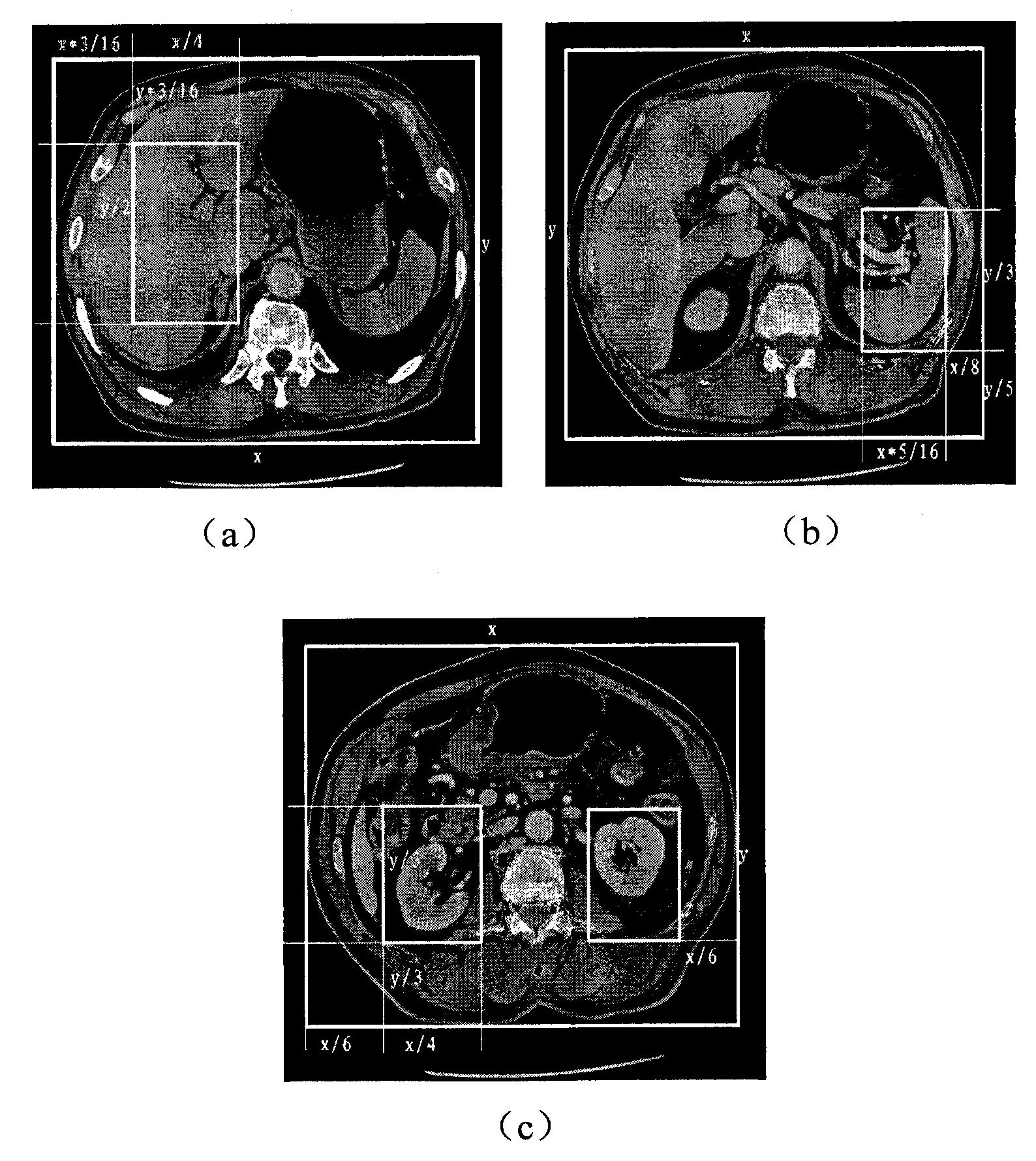 Abdominal organ segmentation method based on secondary three-dimensional region growth