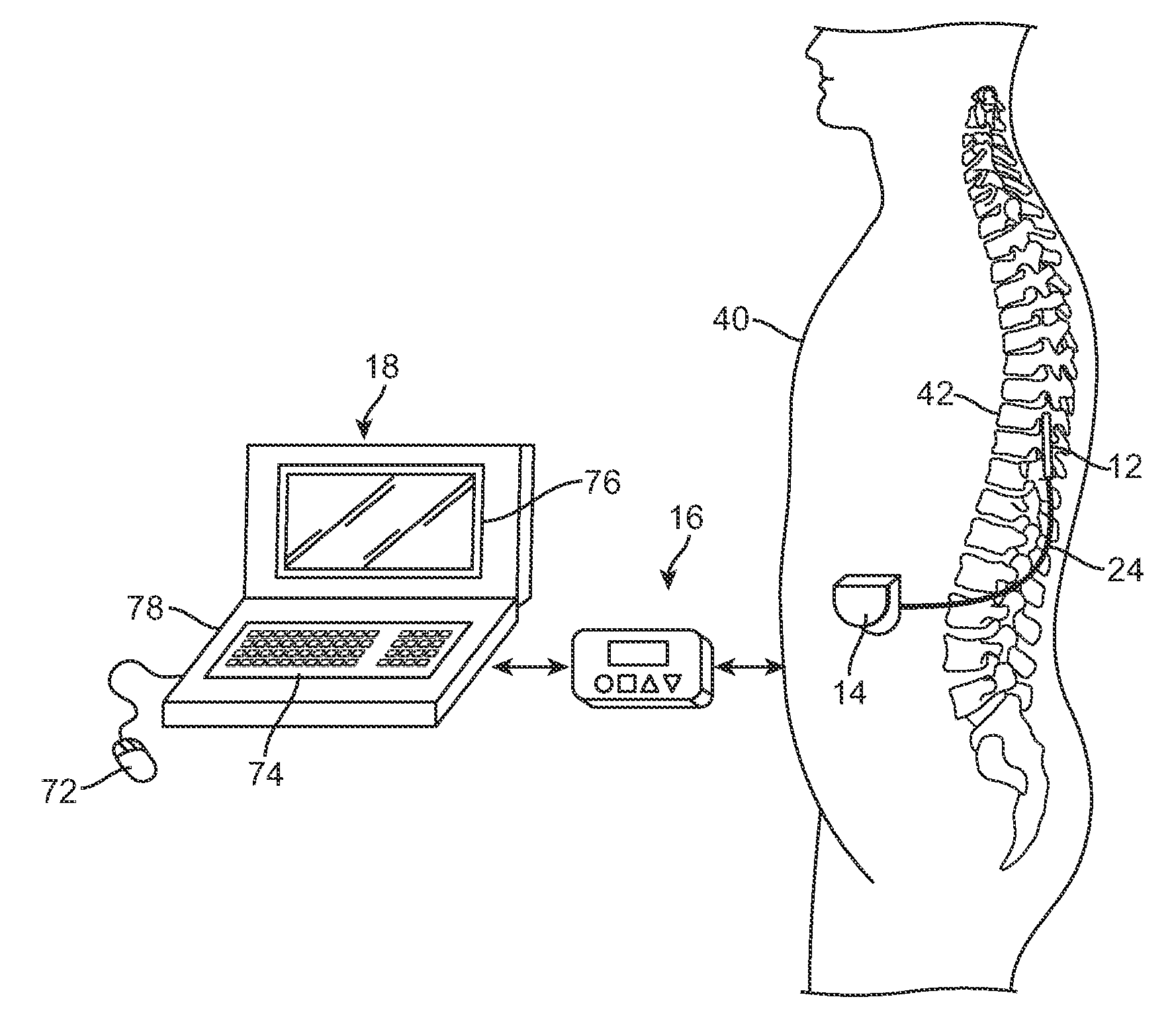 Tissue stimulation system and method with anatomy and physiology driven programming