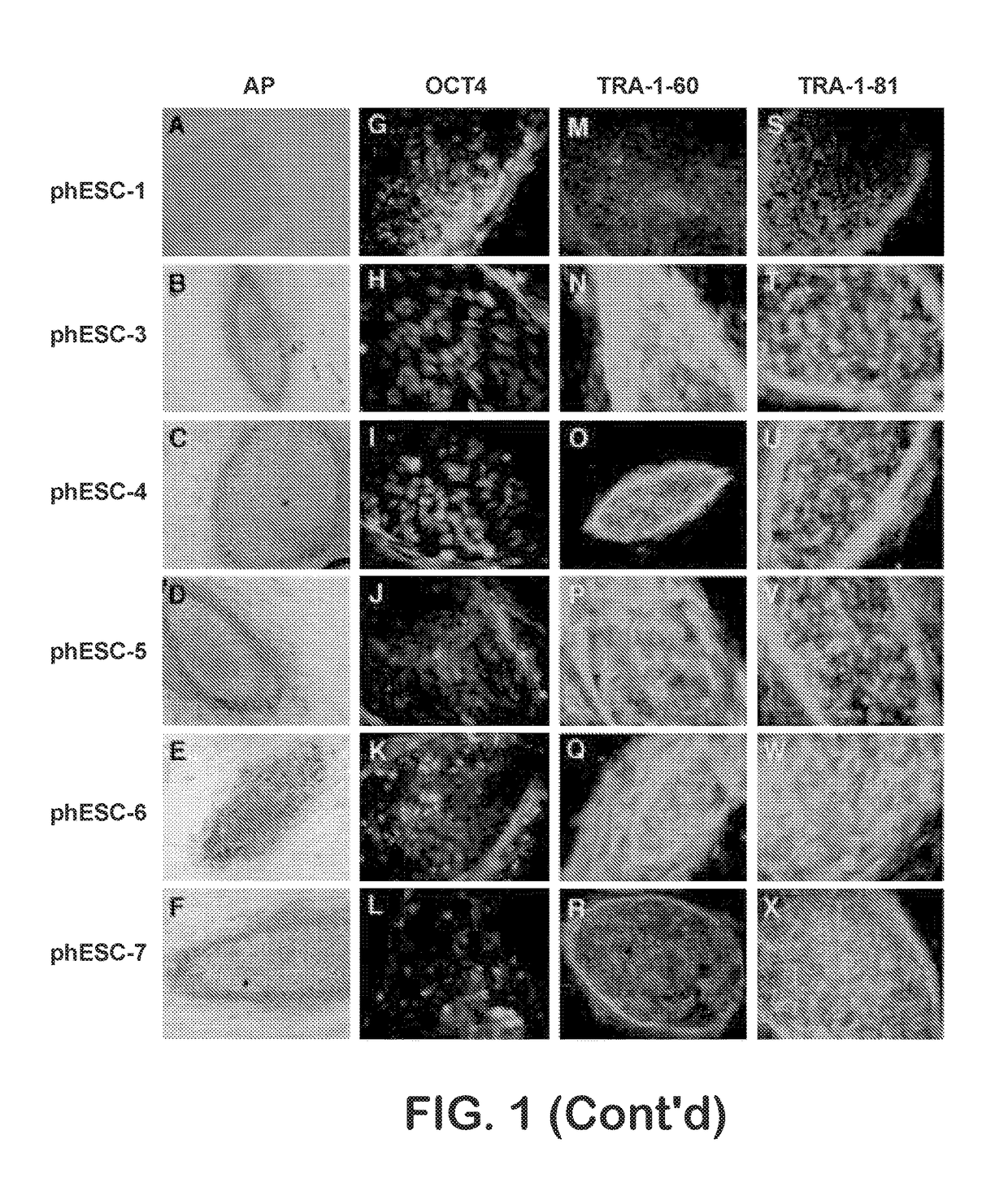 Patient-specific stem cell lines derived from human parthenogenetic blastocysts