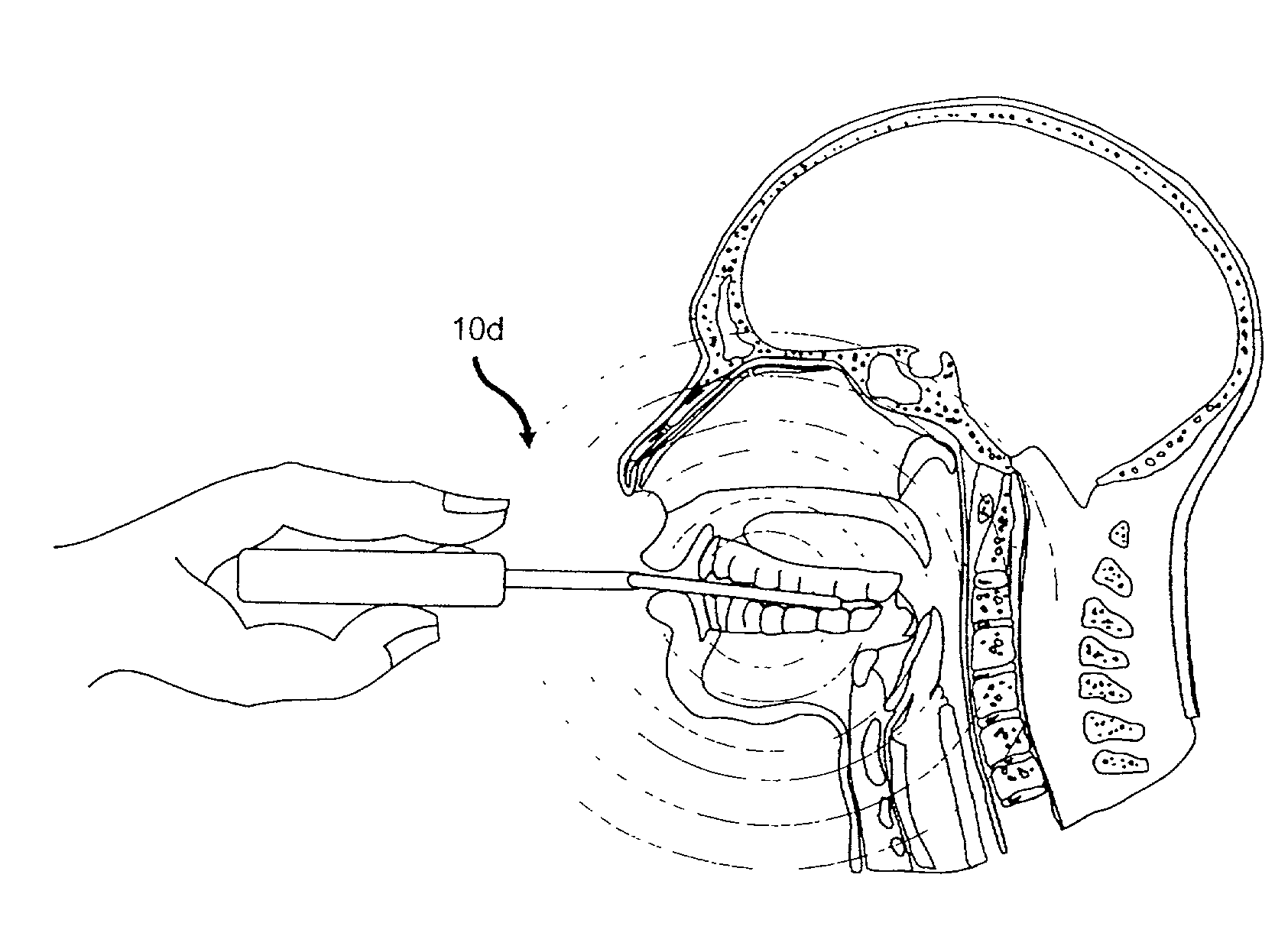 Method and device for treating headaches, sinus congestion and congestion as well as drug withdrawal