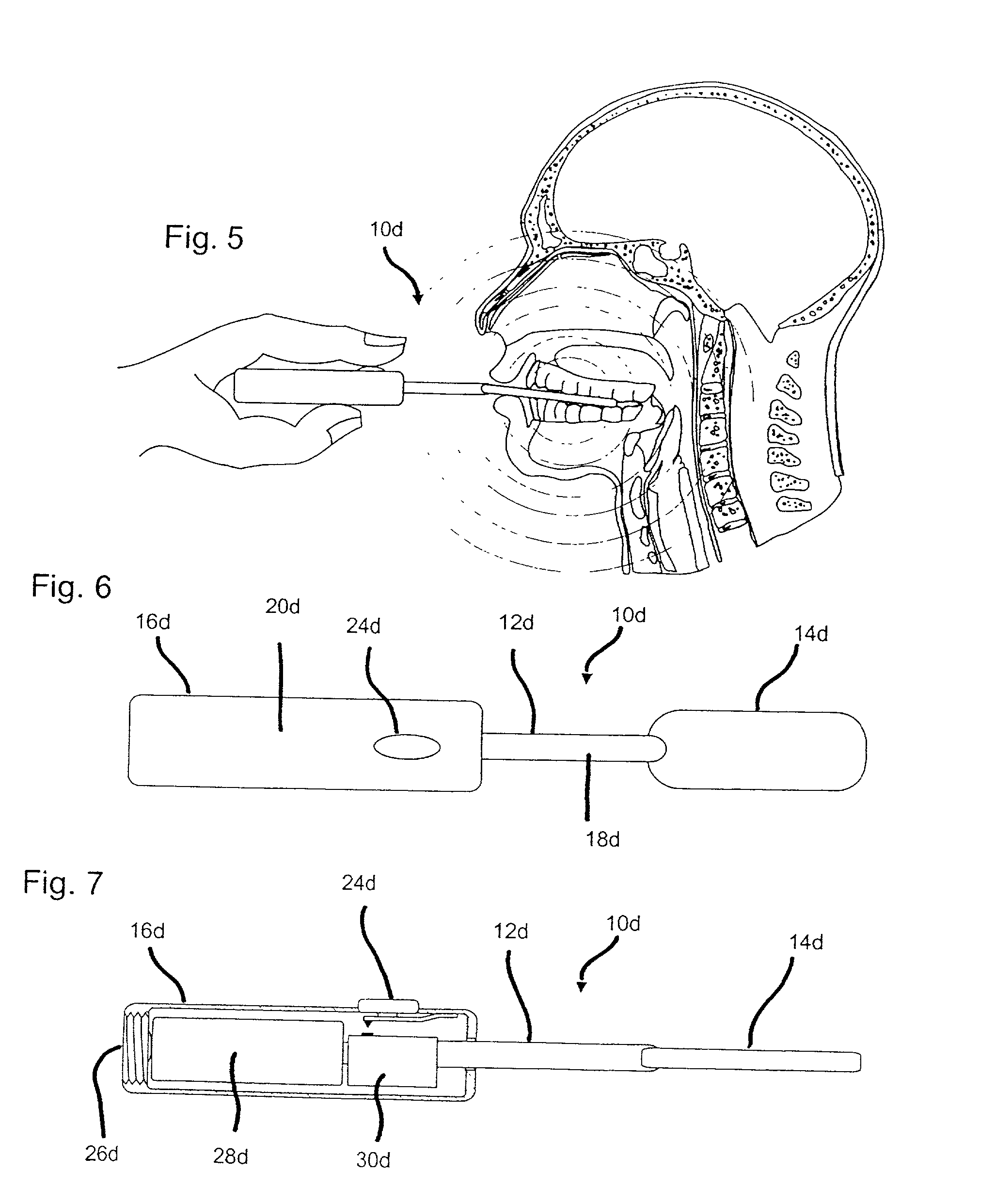 Method and device for treating headaches, sinus congestion and congestion as well as drug withdrawal