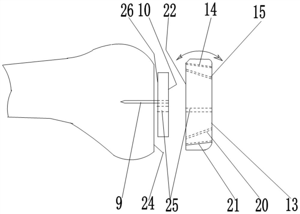 Adjustable bone cutting guide plate for total knee arthroplasty