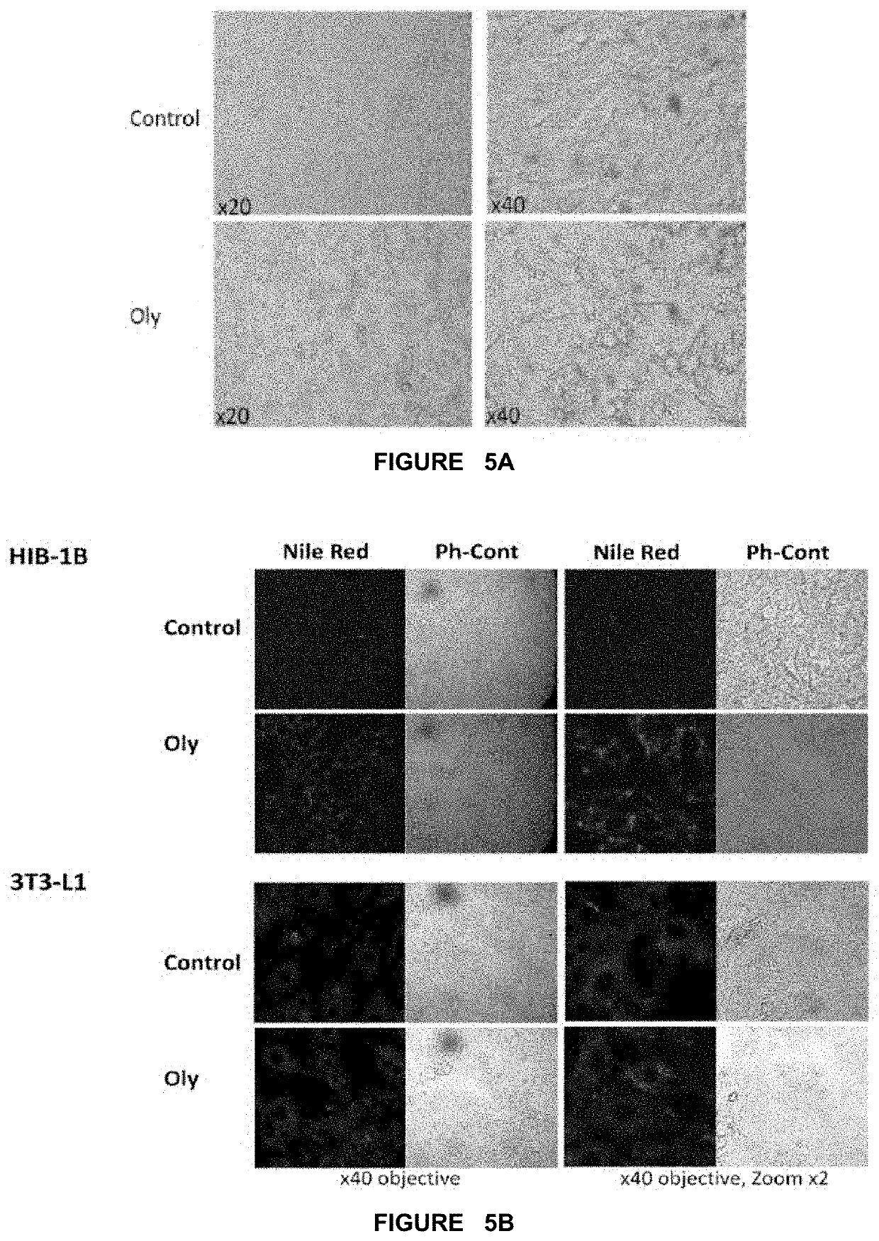 Method of treating overweight or obesity comprising administering a pleurotus ostreatus mushroom extract or a composition comprising a pleurotus ostretus mushroom extract