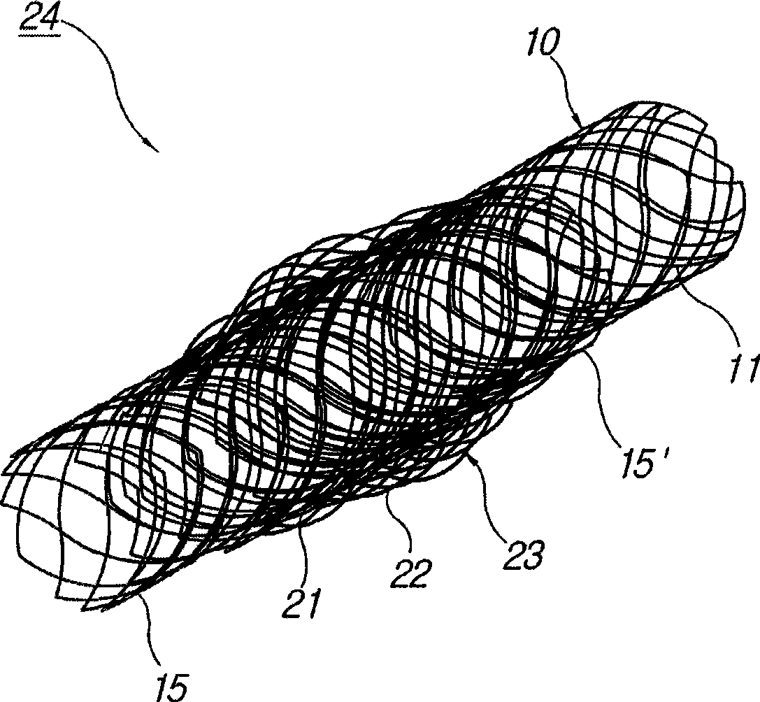 Biodegradable double stent