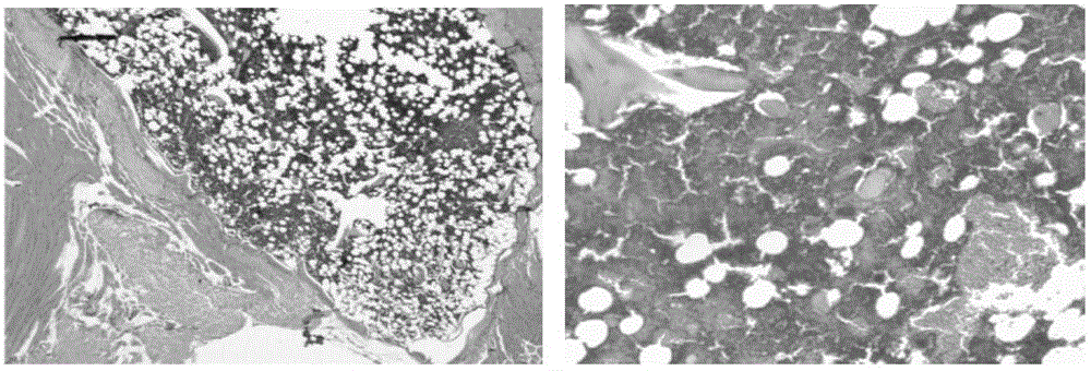 A bioactive factor composition for promoting osteogenesis and vascularization