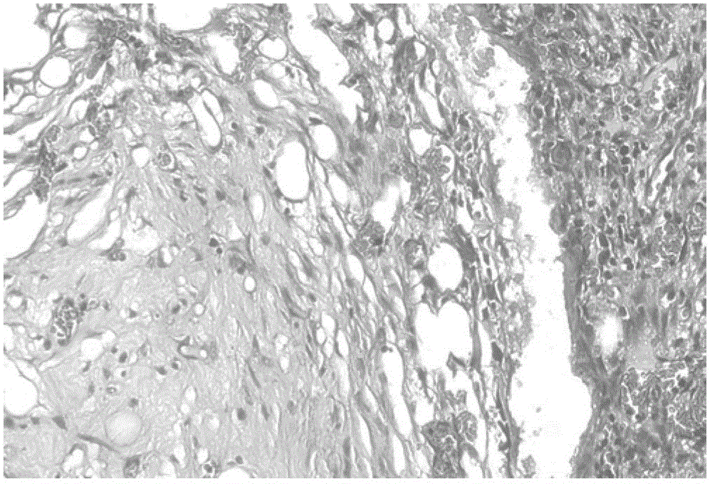 A bioactive factor composition for promoting osteogenesis and vascularization